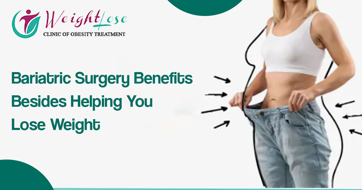 Best Bariatric Surgery For Weight Loss in Sir Ganga Ram Hospital- 7 Benefits
